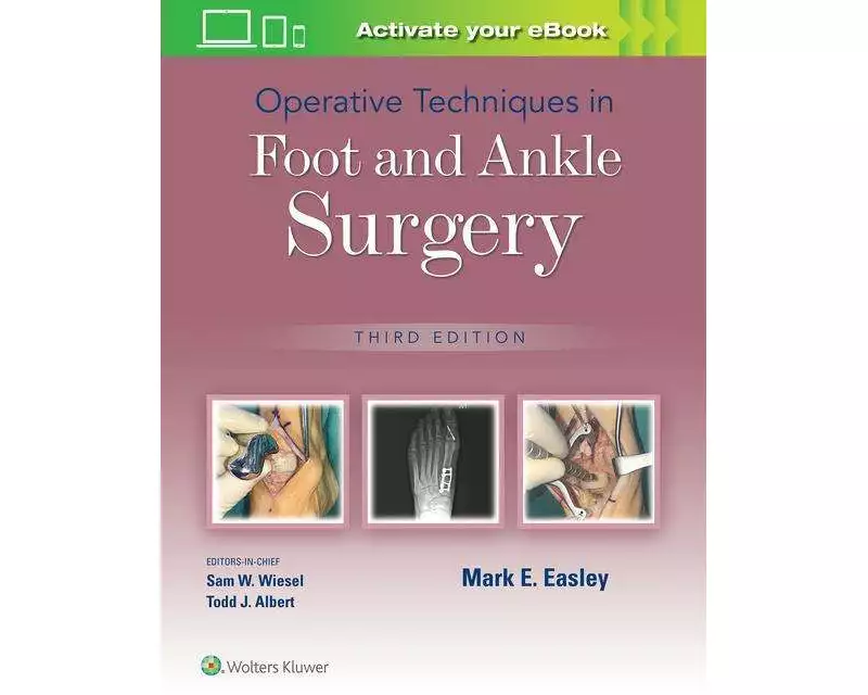 Operative Techniques in Foot and Ankle Surgery