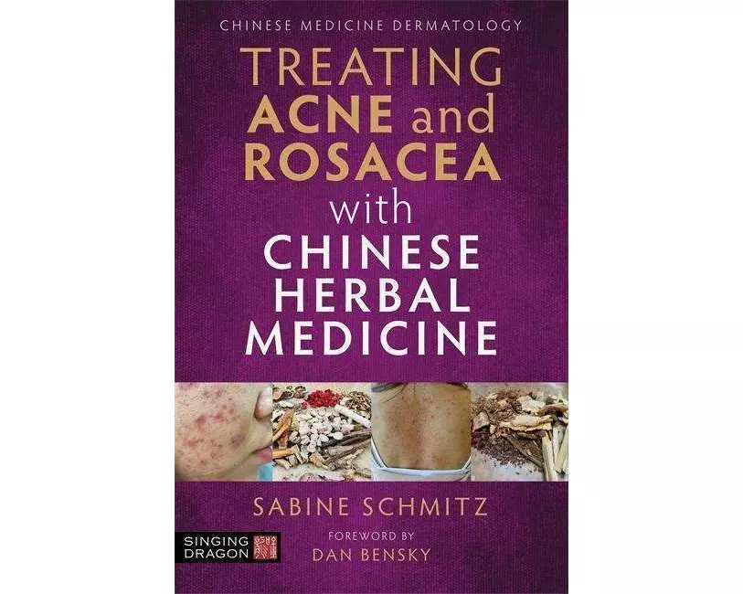 Treating Acne and Rosacea with Chinese Herbal Medicine