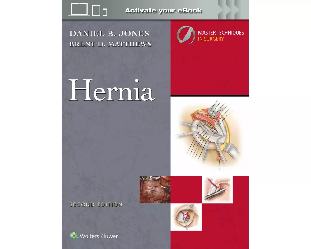 Master Techniques in Surgery: Hernia: Print + eBook with Multimedia