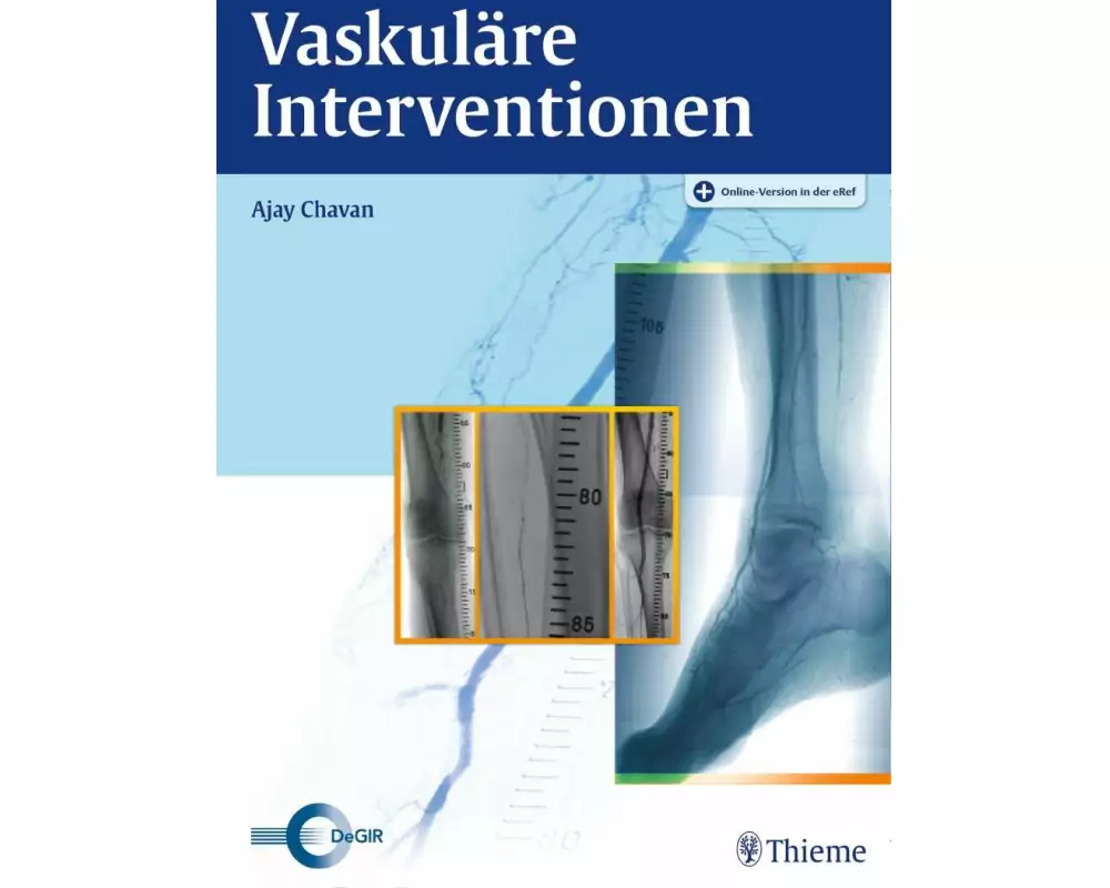 Vaskuläre Interventionen