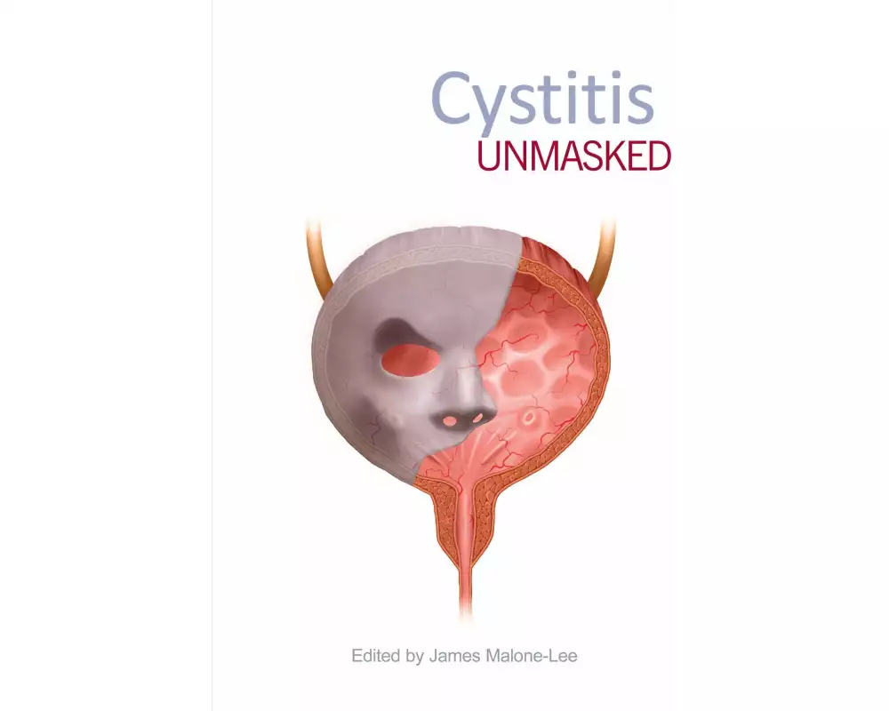 Cystitis Unmasked