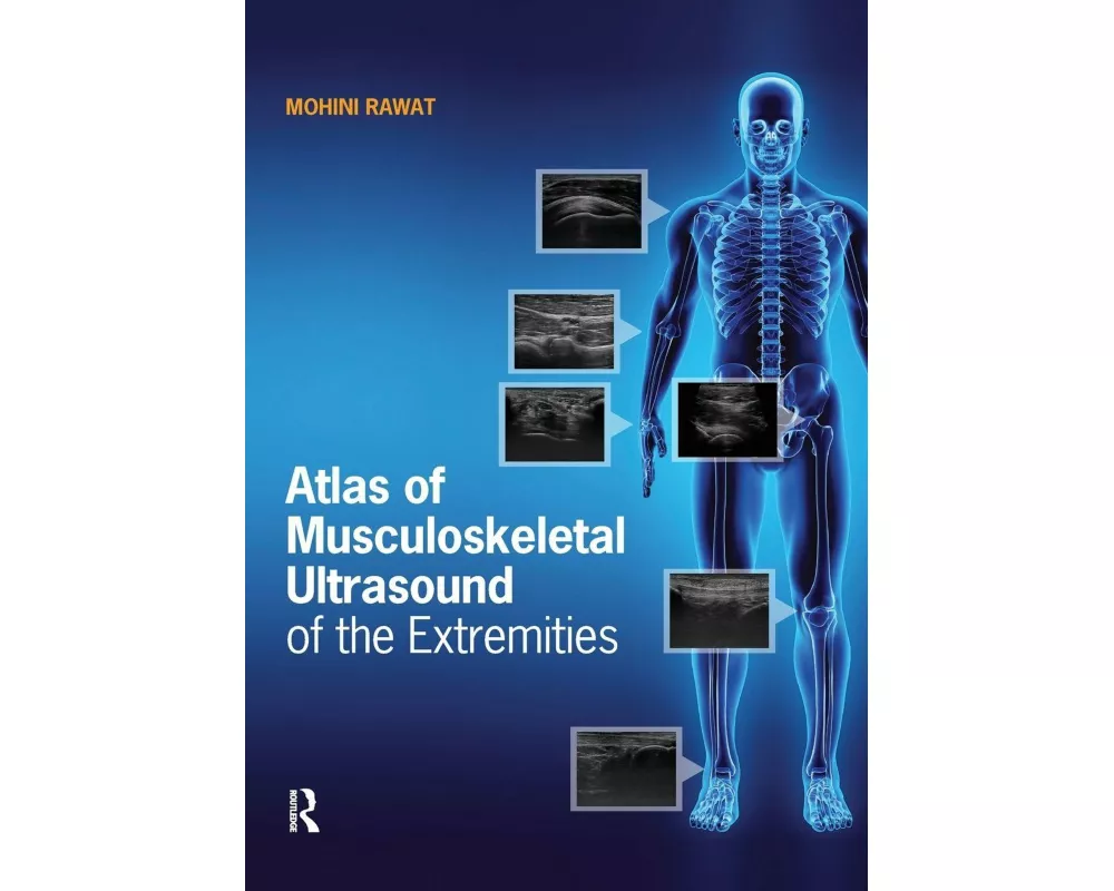 Atlas of Musculoskeletal Ultrasound of the Extremities