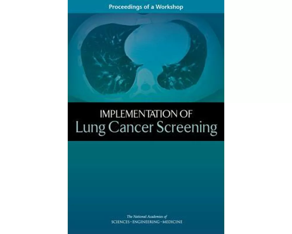 Implementation of Lung Cancer Screening