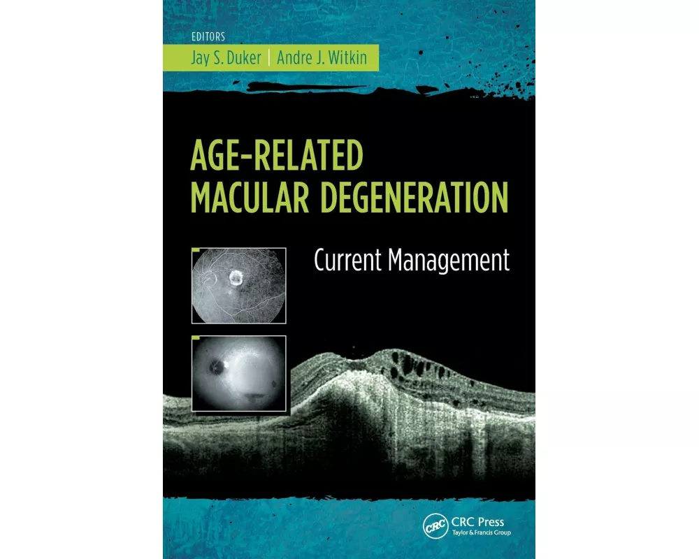 Age-Related Macular Degeneration