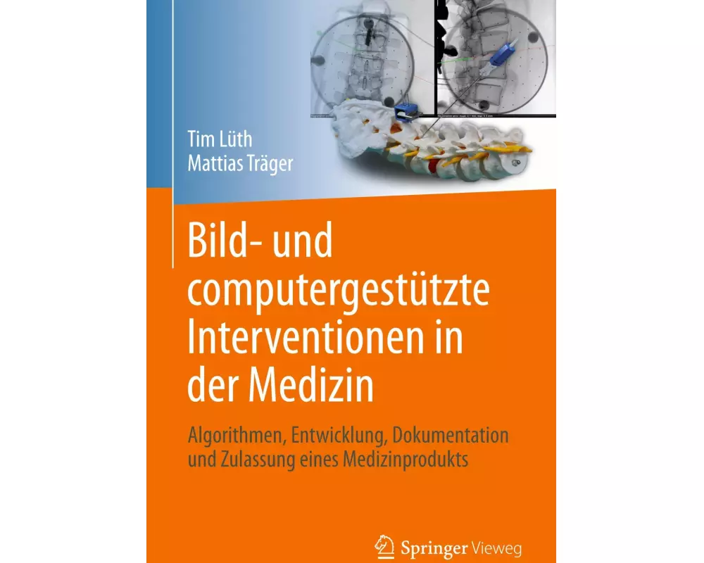 Bild- und computergestützte Interventionen in der Medizin