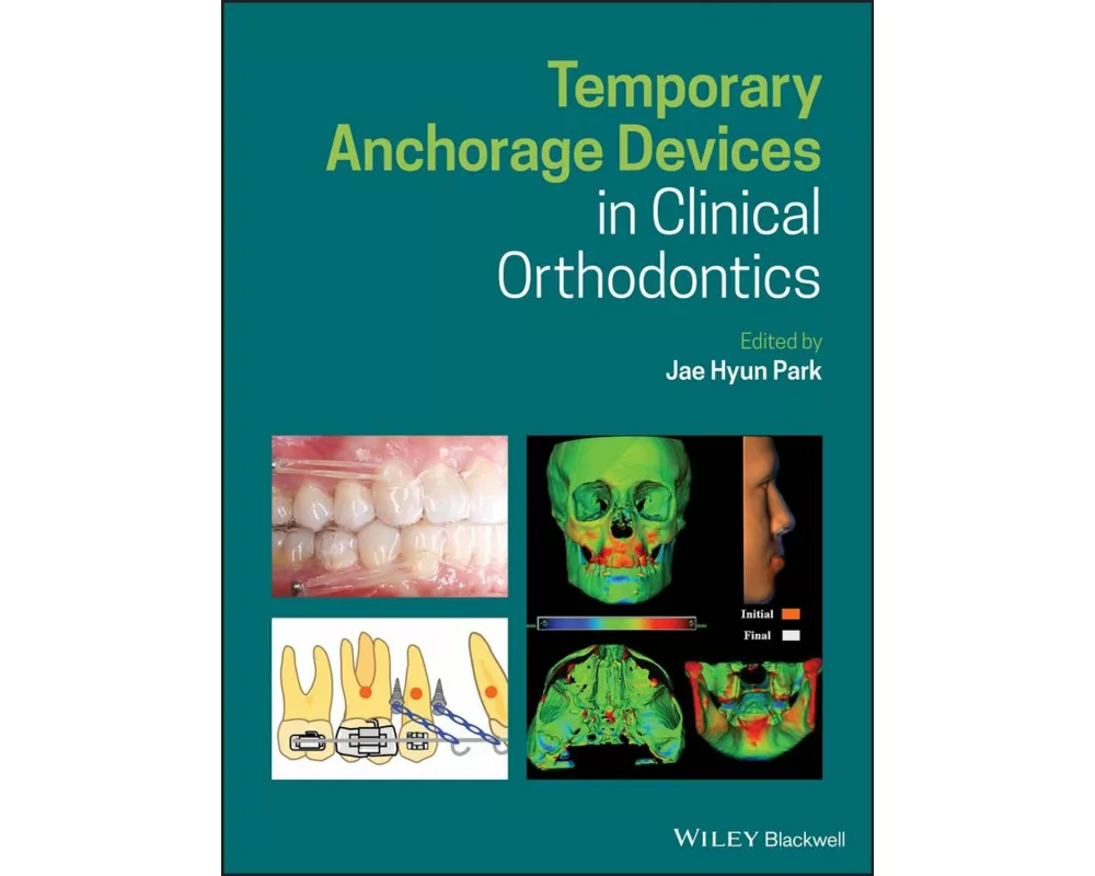 Temporary Anchorage Devices in Clinical Orthodontics