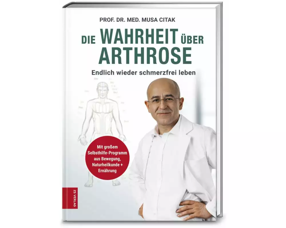 Die Wahrheit über Arthrose