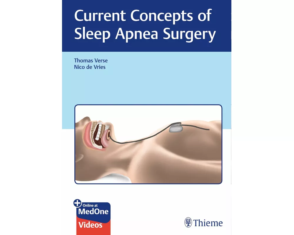 Current Concepts of Sleep Apnea Surgery