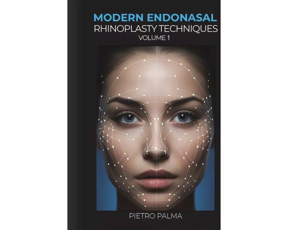 Modern Endonasal Rhinoplasty Techniques – Volume 1