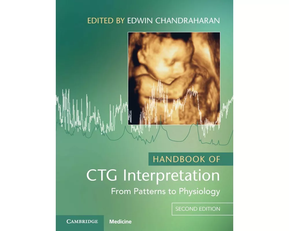 Handbook of CTG Interpretation