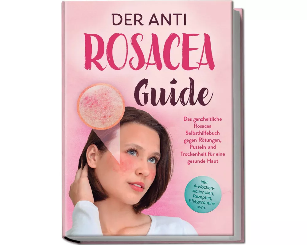 Der Anti Rosacea Guide: Das ganzheitliche Rosacea Selbsthilfebuch gegen Rötungen, Pusteln und Trockenheit für eine gesunde Haut - inkl. 4¿Wochen¿Actio