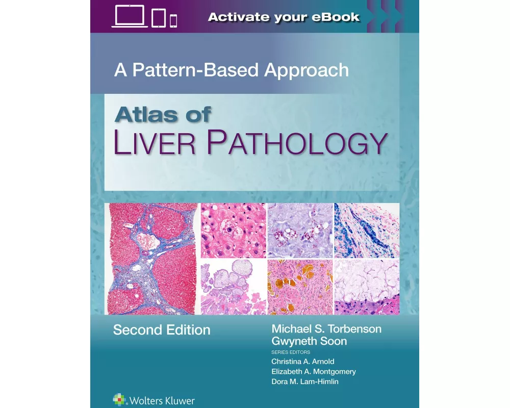 Atlas of Liver Pathology