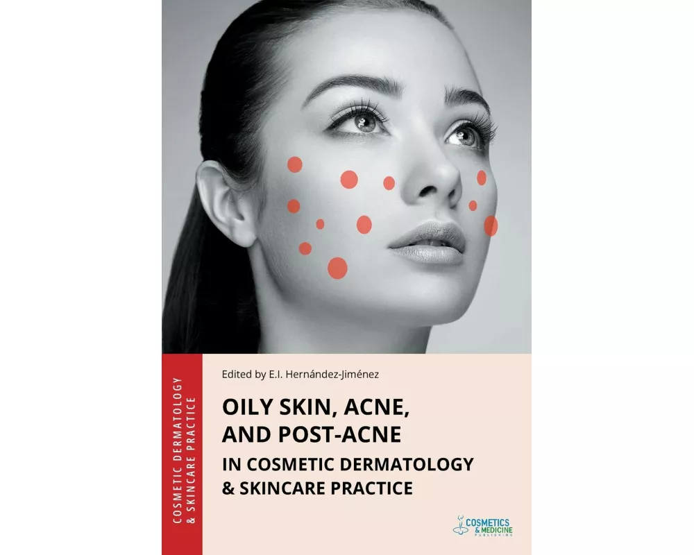 Oily Skin, Acne, and Post-Acne in Cosmetic Dermatology & Skincare Practice