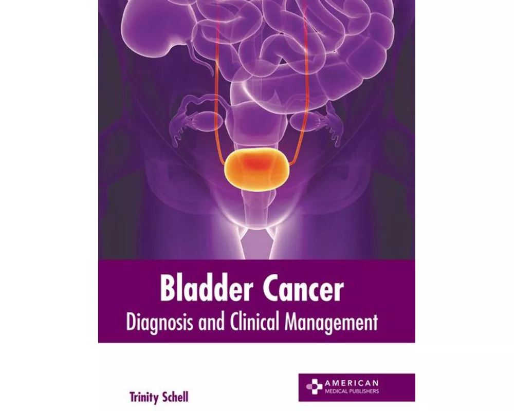 Bladder Cancer