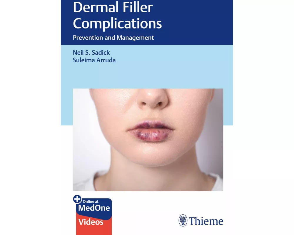Dermal Filler Complications