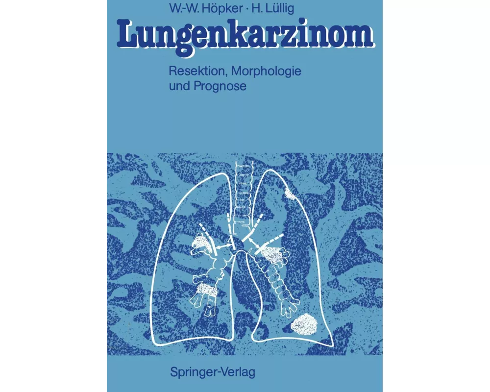 Lungenkarzinom