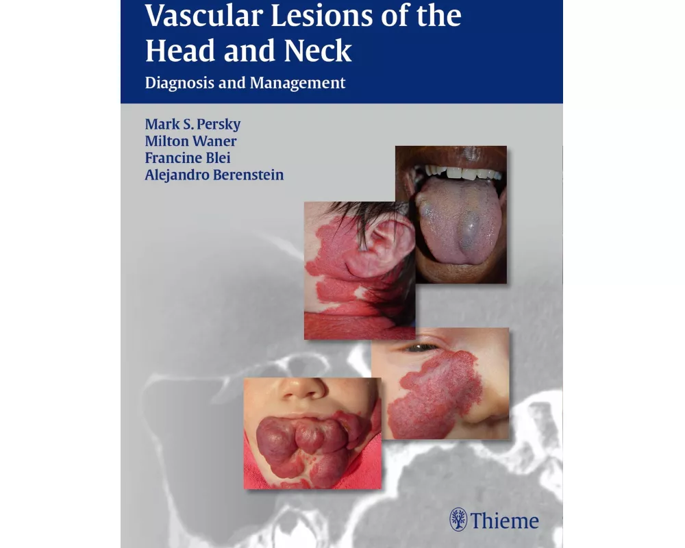 Vascular Lesions of the Head and Neck