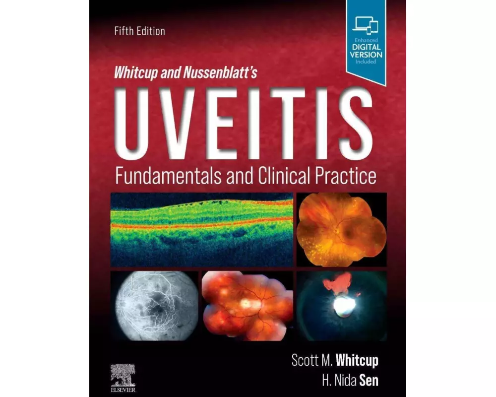 Whitcup and Nussenblatt's Uveitis