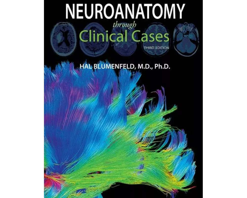 Neuroanatomy through Clinical Cases