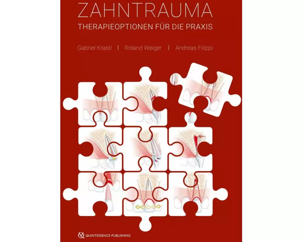 Zahntrauma