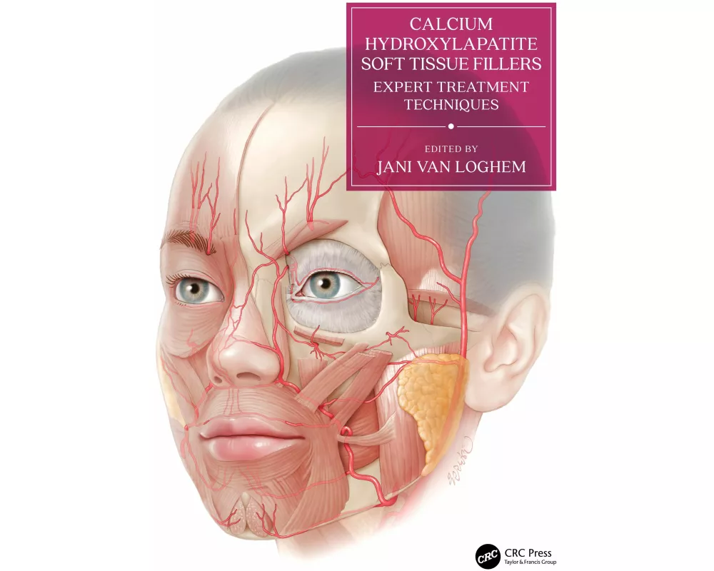 Calcium Hydroxylapatite Soft Tissue Fillers