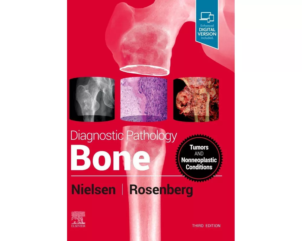 Diagnostic Pathology: Bone
