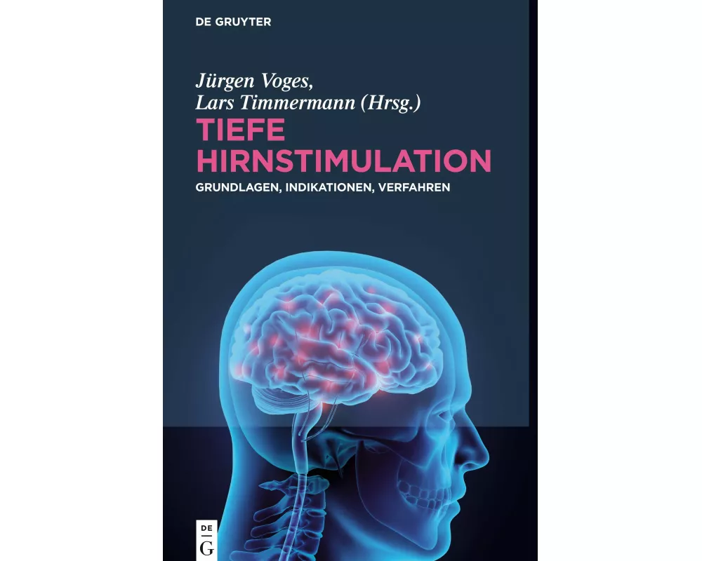 Tiefe Hirnstimulation