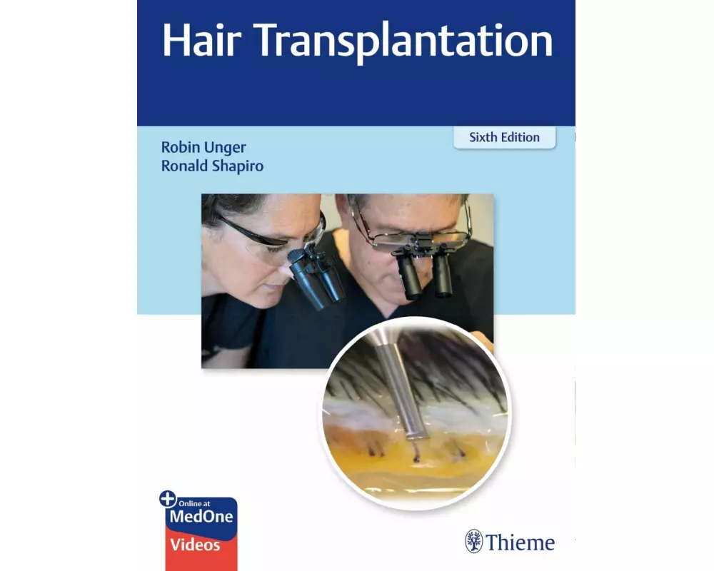 Hair Transplantation