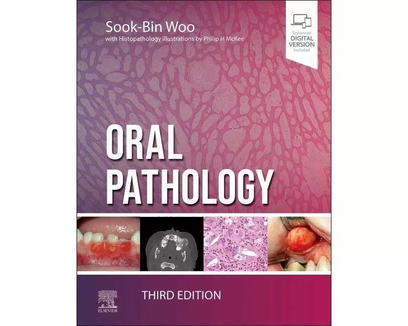 Oral Pathology