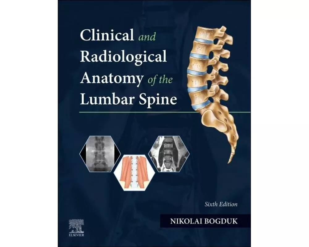 Clinical and Radiological Anatomy of the Lumbar Spine