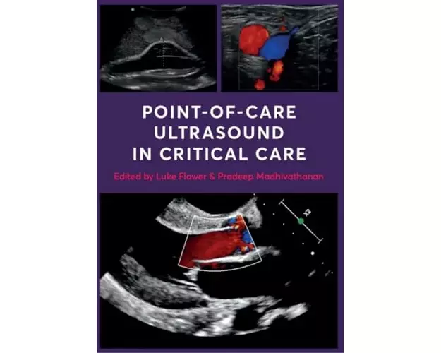 Point-of-Care Ultrasound in Critical Care