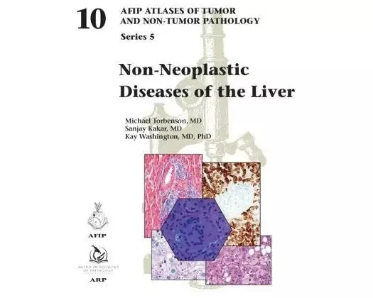Non-Neoplastic Diseases of the Liver