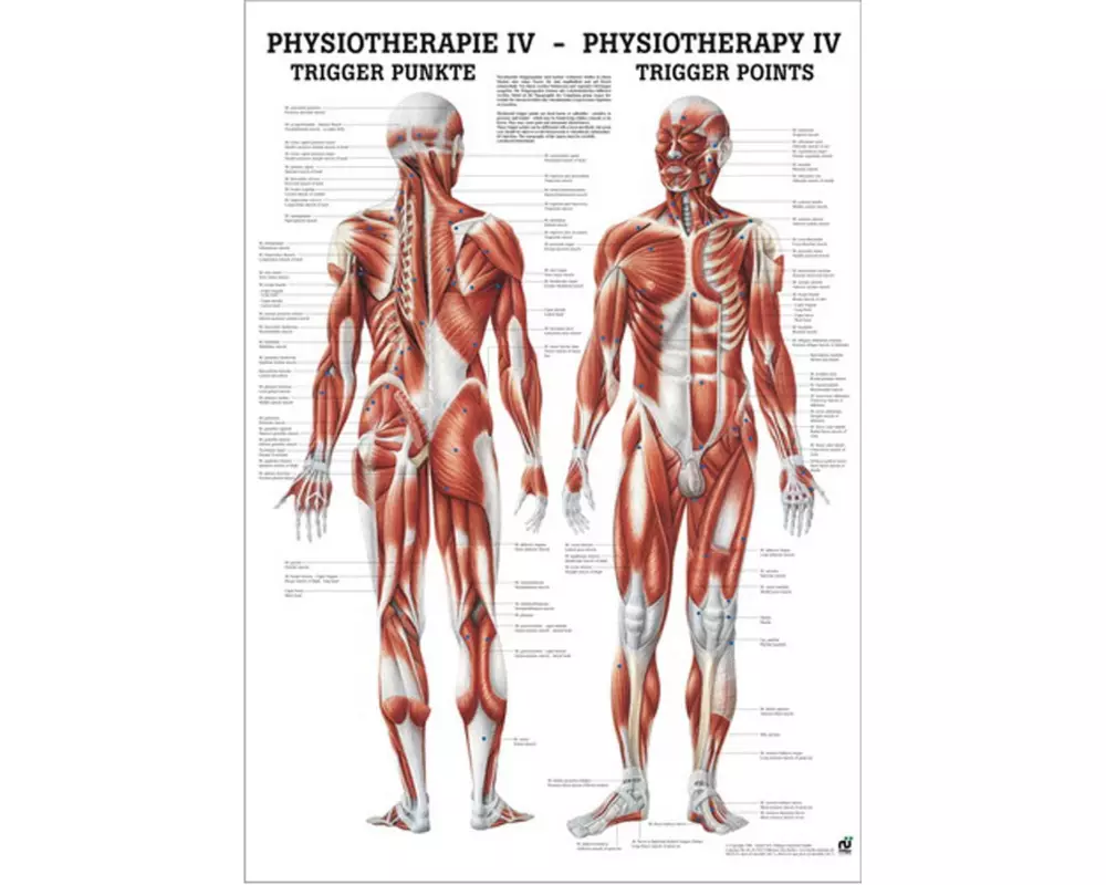 Rüdiger Physiotherapie-Poster – Trigger Punkte Deutsch/Englisch