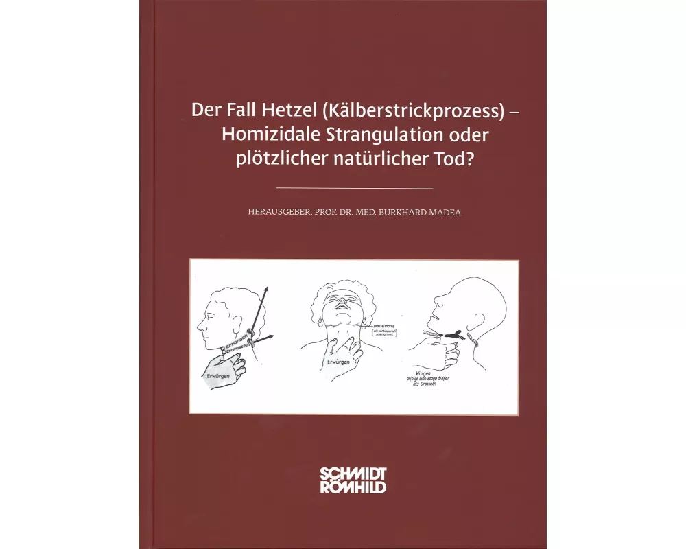 Der Fall Hetzel (Kälberstrickprozess) - Homizidale Strangulation oder plötzlicher natürlicher Tod?
