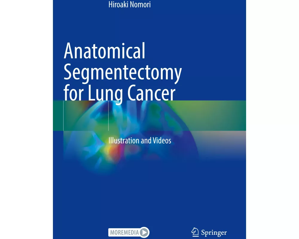 Anatomical Segmentectomy for Lung Cancer