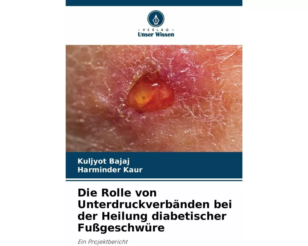 Die Rolle von Unterdruckverbänden bei der Heilung diabetischer Fußgeschwüre