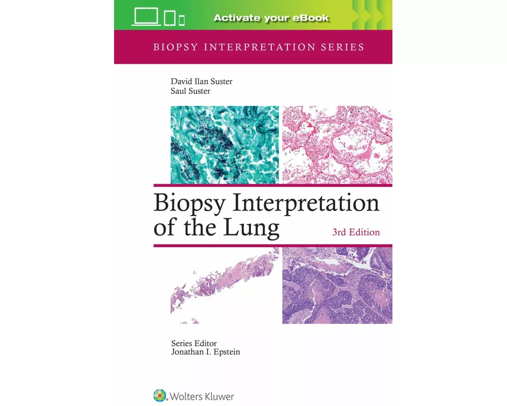 Biopsy Interpretation of the Lung