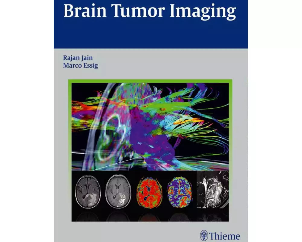 Brain Tumor Imaging