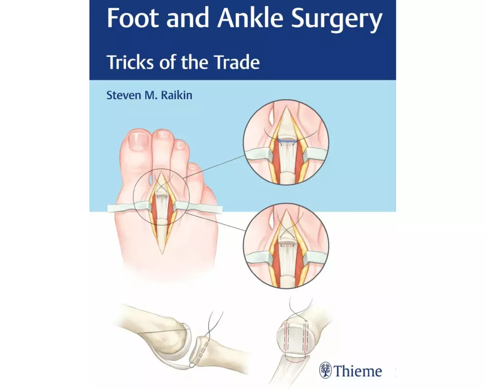 Foot and Ankle Surgery
