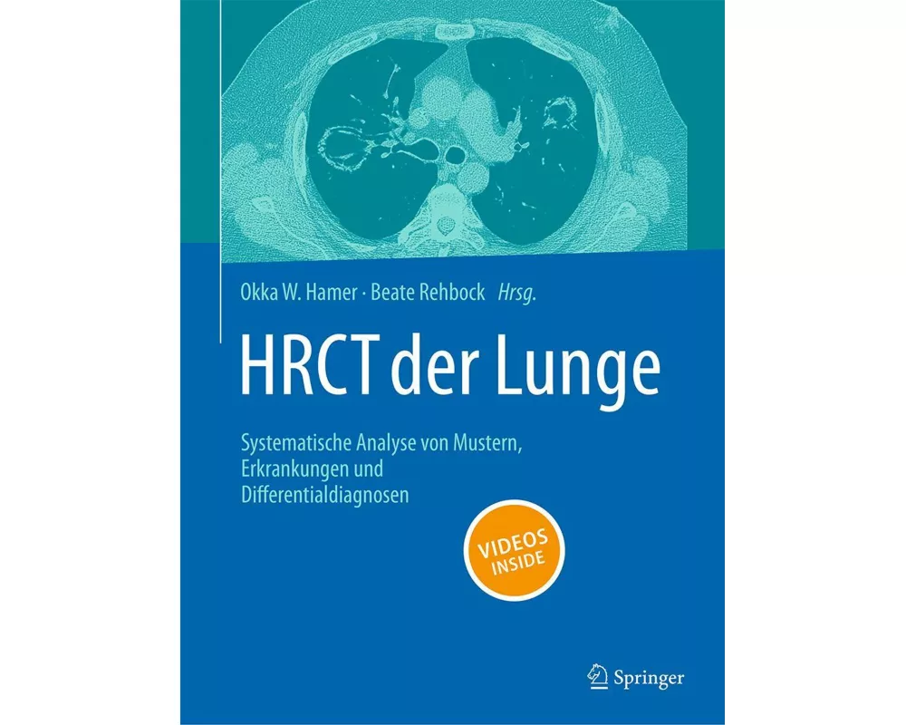 HRCT der Lunge