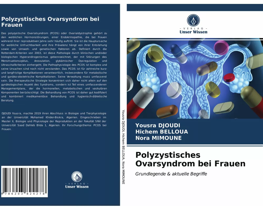 Polyzystisches Ovarsyndrom bei Frauen
