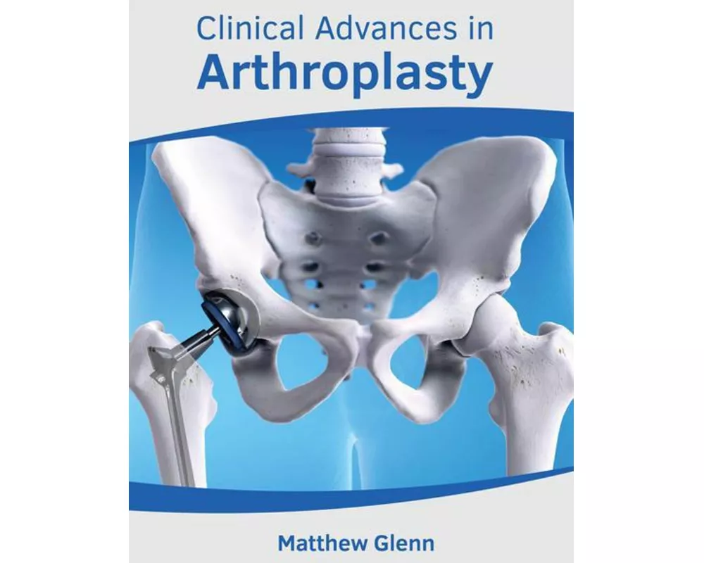 Clinical Advances in Arthroplasty