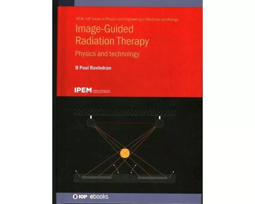 Image-Guided Radiation Therapy