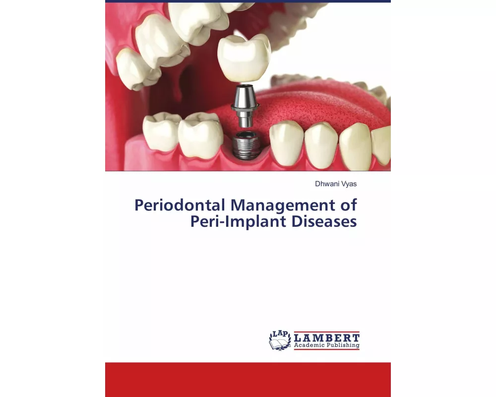 Periodontal Management of Peri-Implant Diseases