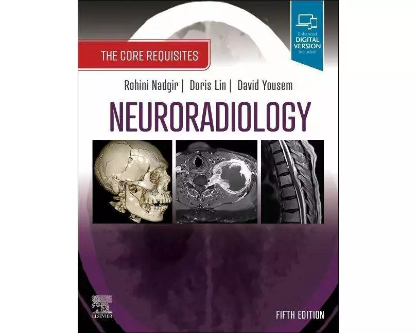Neuroradiology