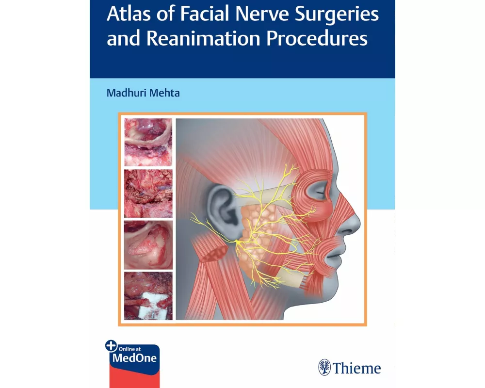Atlas of Facial Nerve Surgeries and Reanimation Procedures
