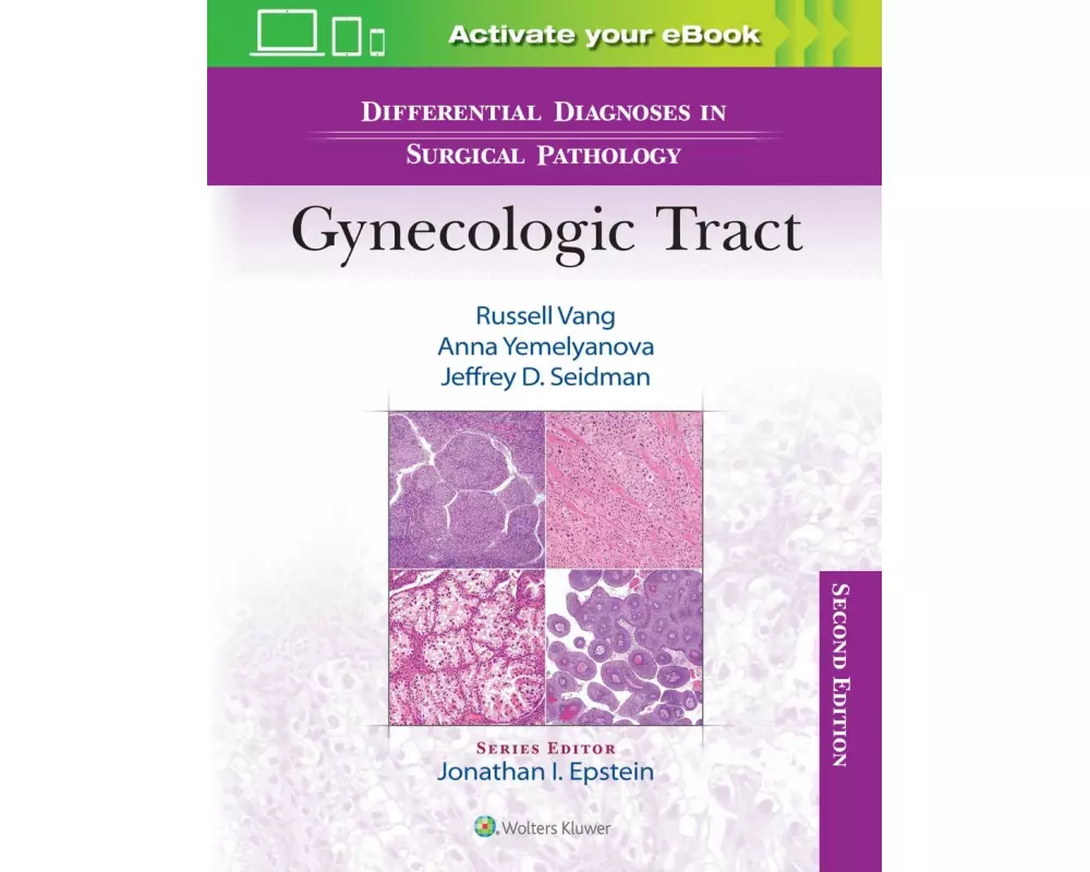 Differential Diagnoses in Surgical Pathology: Gynecologic Tract