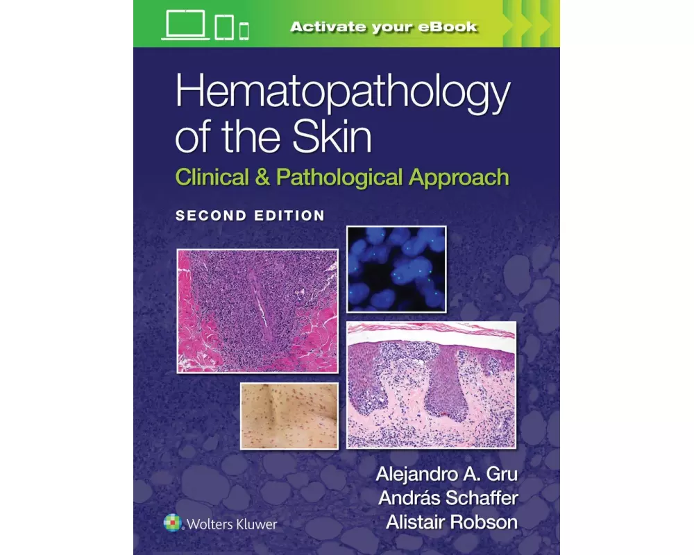 Hematopathology of the Skin