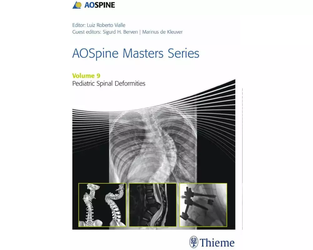AOSpine Masters Series, Volume 9: Pediatric Spinal Deformities
