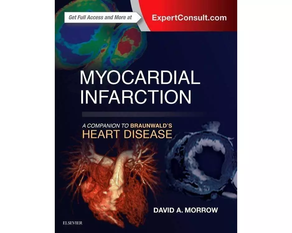 Myocardial Infarction: A Companion to Braunwald's Heart Disease